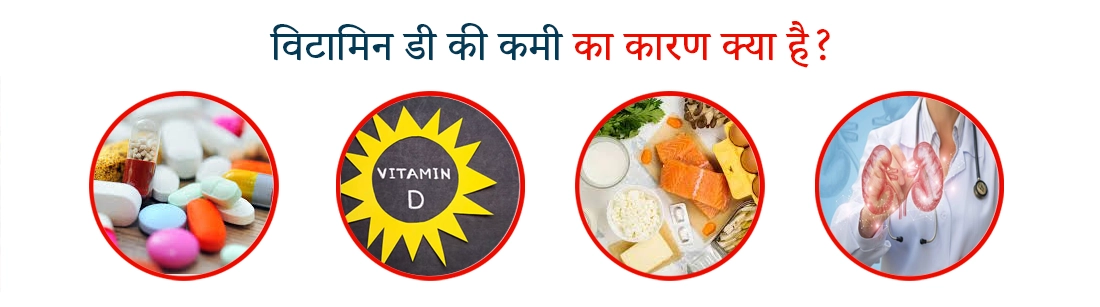 Causes of Vitamin D Deficiency in Hindi